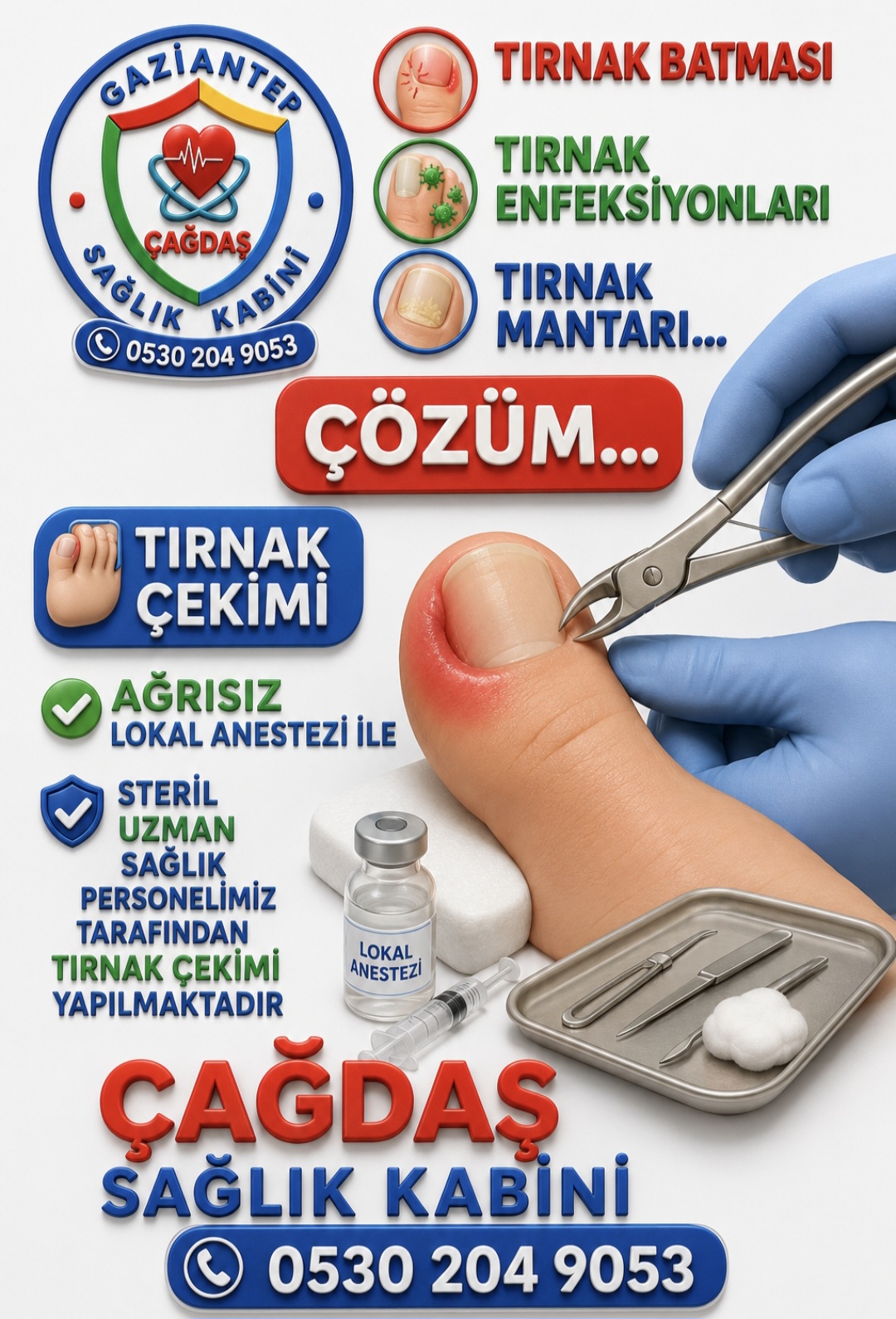 Tırnak Batması 